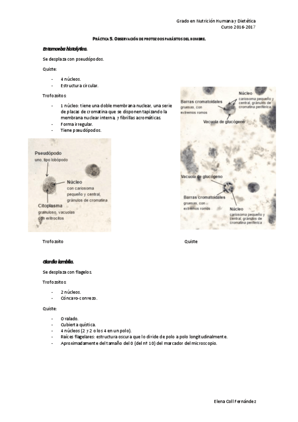 Miniatura del documento Práctica 5. Protozoos. Parasitología Alimentaria.pdf