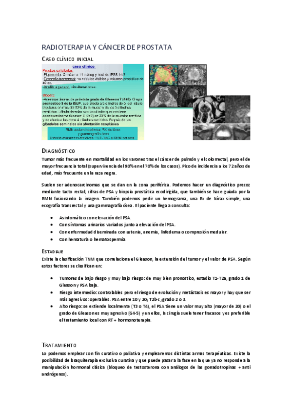 Miniatura del documento CANCER-DE-PROSTATA.pdf