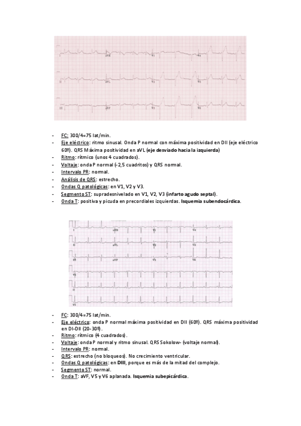 Miniatura del documento ECG-Semiologia-resueltos.pdf
