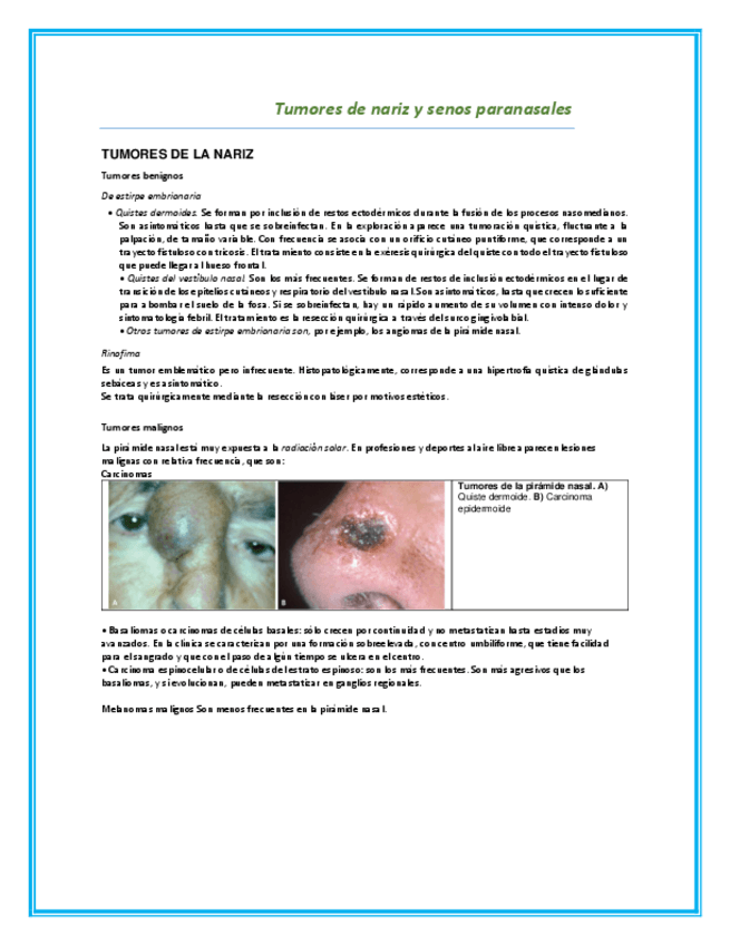 Miniatura del documento Tumores-de-nariz-y-senos-paranasales.pdf