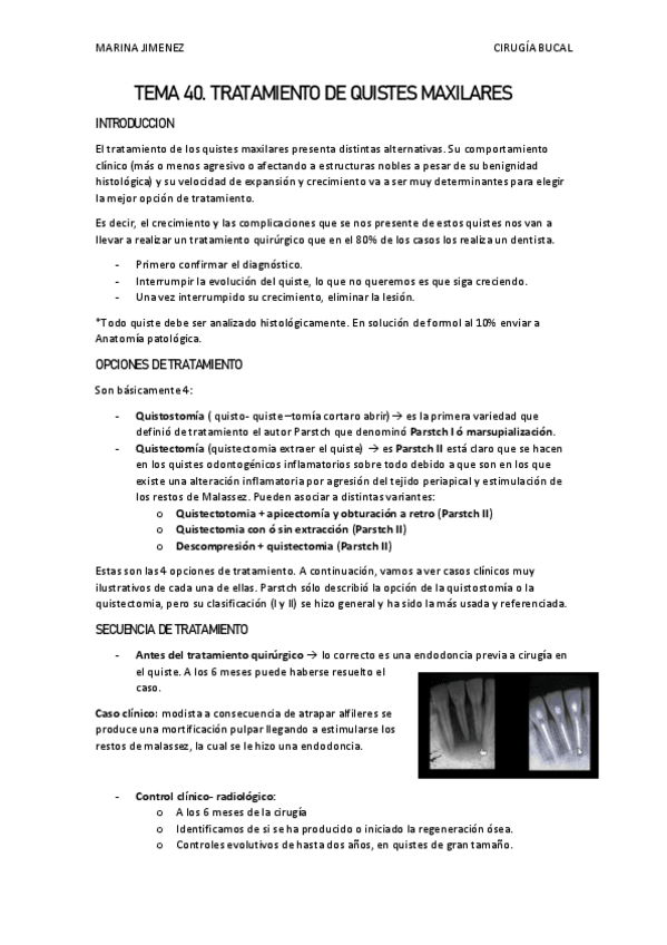 Miniatura del documento TEMA-40-TRATAMIENTO-DE-LOS-QUISTES-MAXILARES.pdf