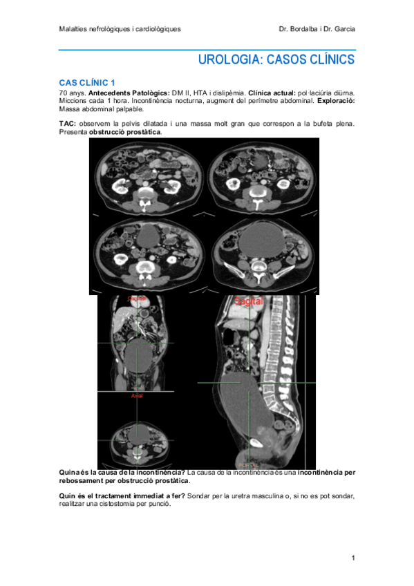 Miniatura del documento URO-CasosClinics.pdf
