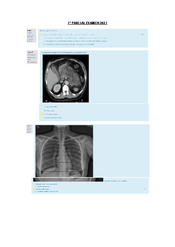 Miniatura del documento 1o-PARCIAL-EXAMEN-2021.pdf