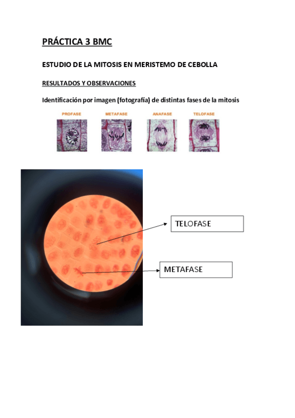 Miniatura del documento PRACTICA-3-BMC.pdf