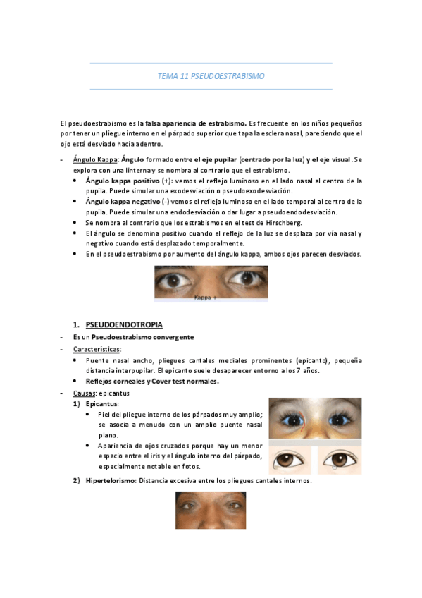 Miniatura del documento TEMA-11-PSEUDOESTRABISMO.pdf