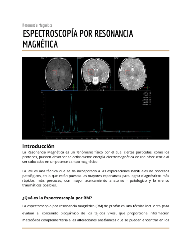 Miniatura del documento Espectroscopia-por-RM-1.docx