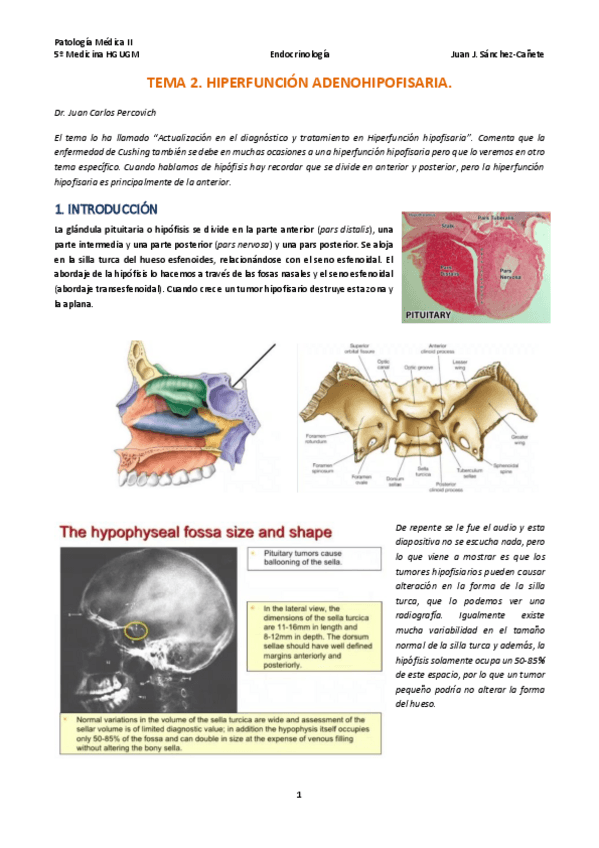 Miniatura del documento TEMA-2-HIPERFUNCION-ADENOHIPOFISARIA.pdf