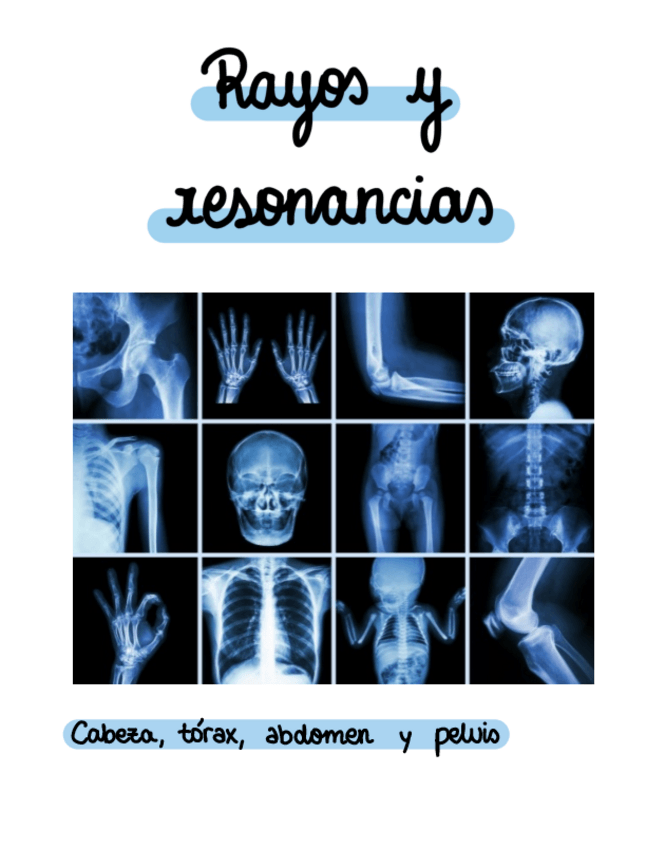 Miniatura del documento Rayos-cabeza-y-torax.pdf