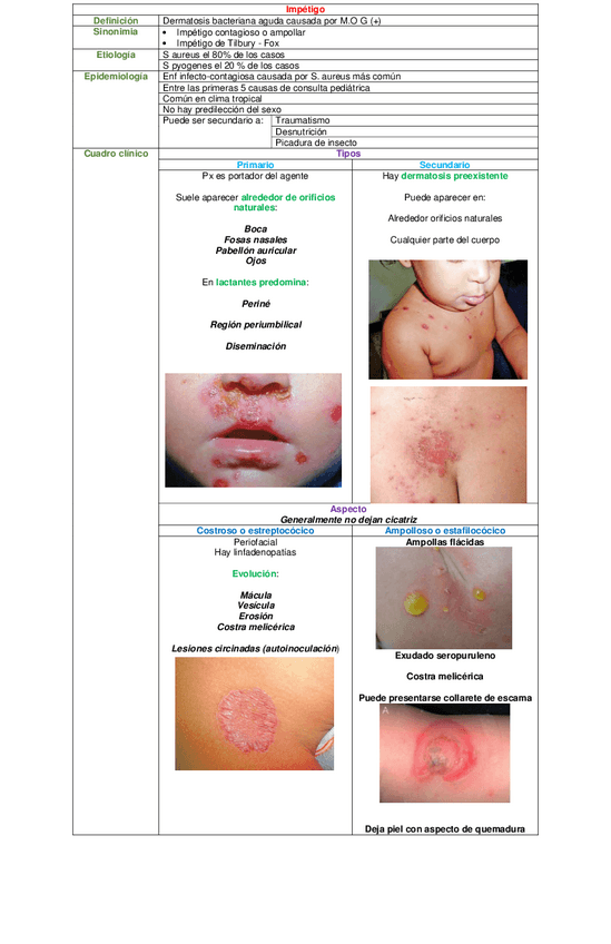 Miniatura del documento CUADRO-IMPETIGO.pdf
