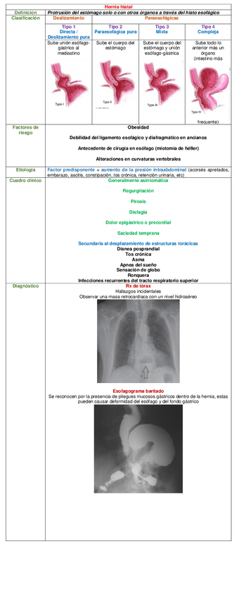 Miniatura del documento CUADRO-HERNIA-HIATAL.pdf