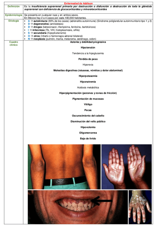 Miniatura del documento CUADRO-ENFERMEDAD-DE-ADDISON.pdf