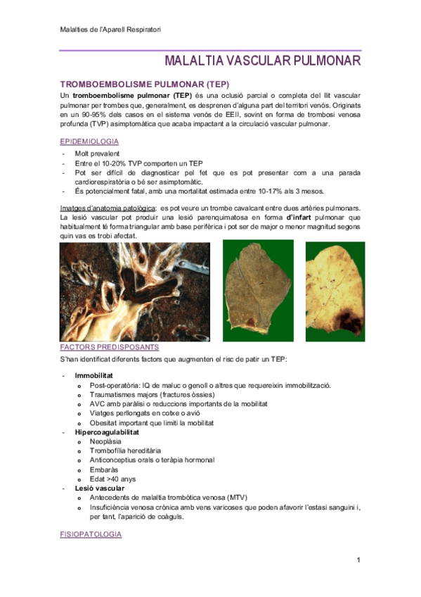 Miniatura del documento 7-MalaltiaVascularPulmonar.pdf