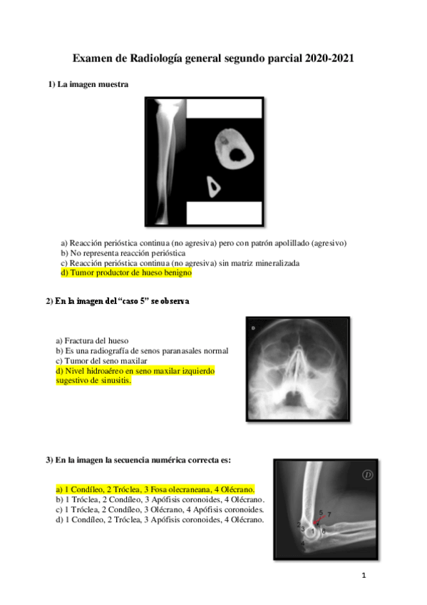 Miniatura del documento Examen-de-radiologia-general-segundo-parcial-2020-2021.pdf