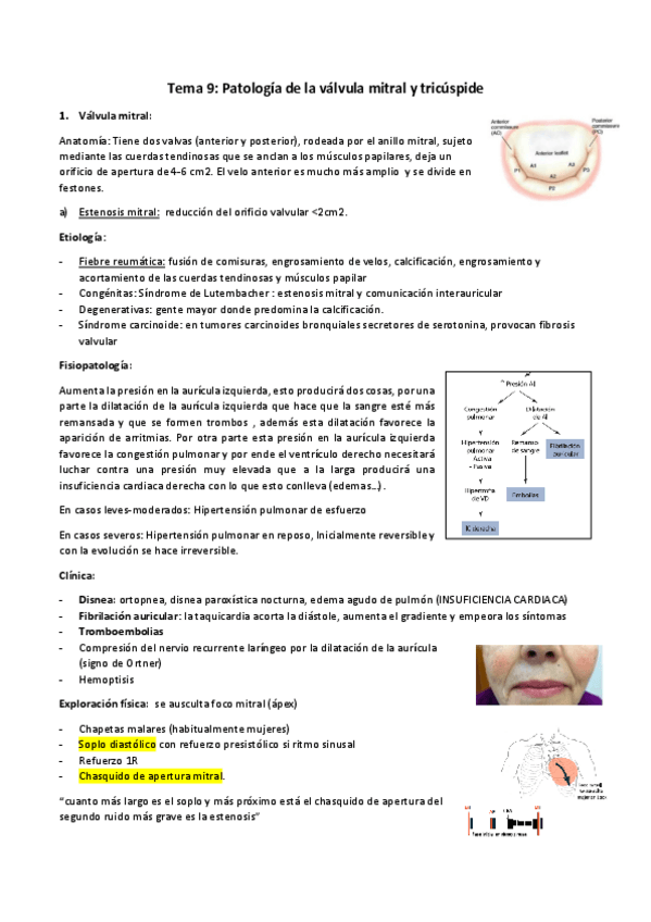 Miniatura del documento Tema-9-Valvulas.pdf