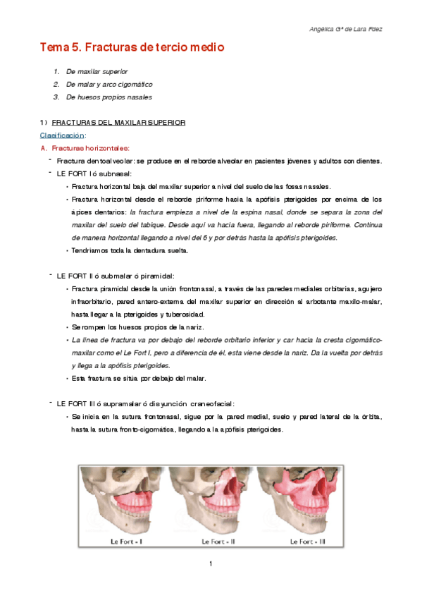 Miniatura del documento Tema 5.pdf