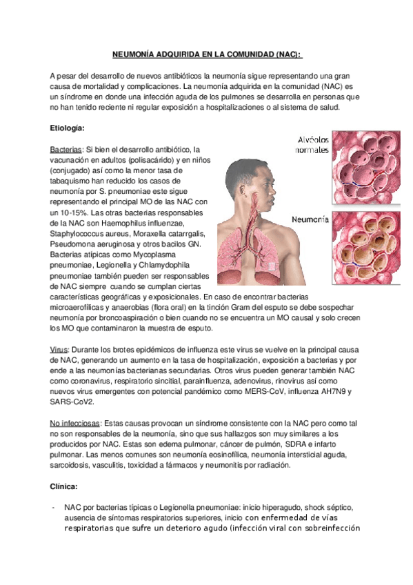 Miniatura del documento NEUMONIA-ADQUIRIDA-EN-LA-COMUNIDAD-NAC.docx