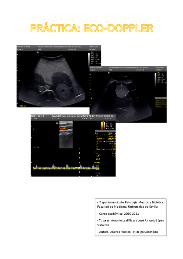 Miniatura del documento Practica-Ecografia-Doppler.pdf