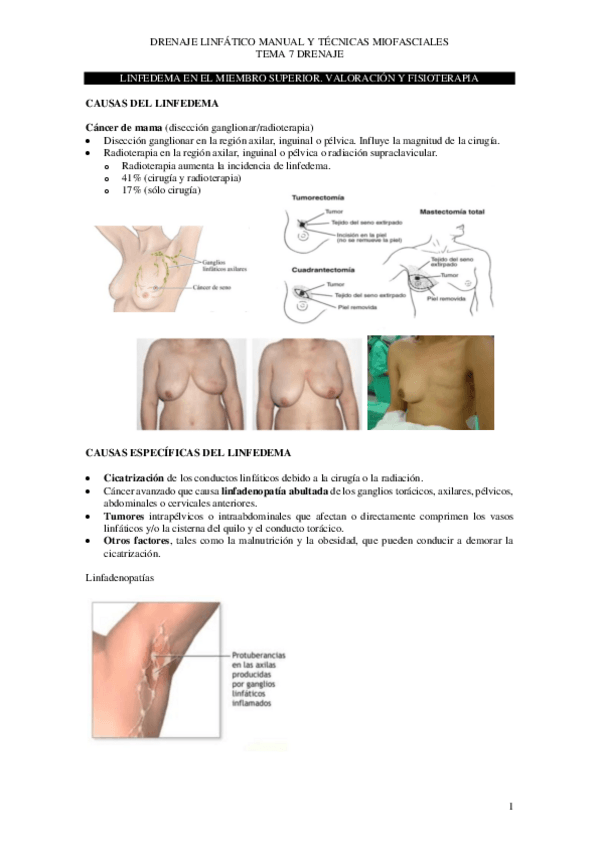 Miniatura del documento Tema-7-drenaje-copia.pdf