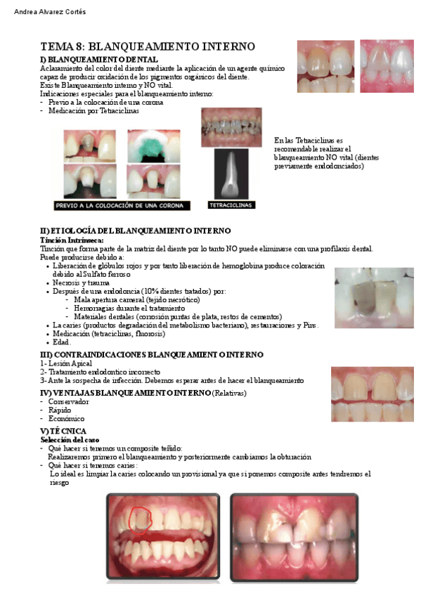 Miniatura del documento Tema-8-PTD-IV.pdf