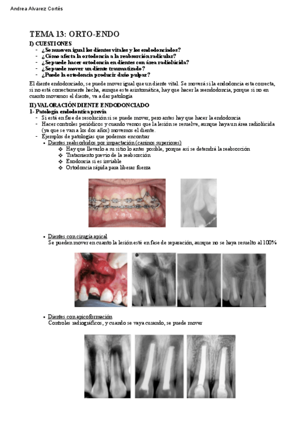 Miniatura del documento Tema-13-PTD-IV.pdf