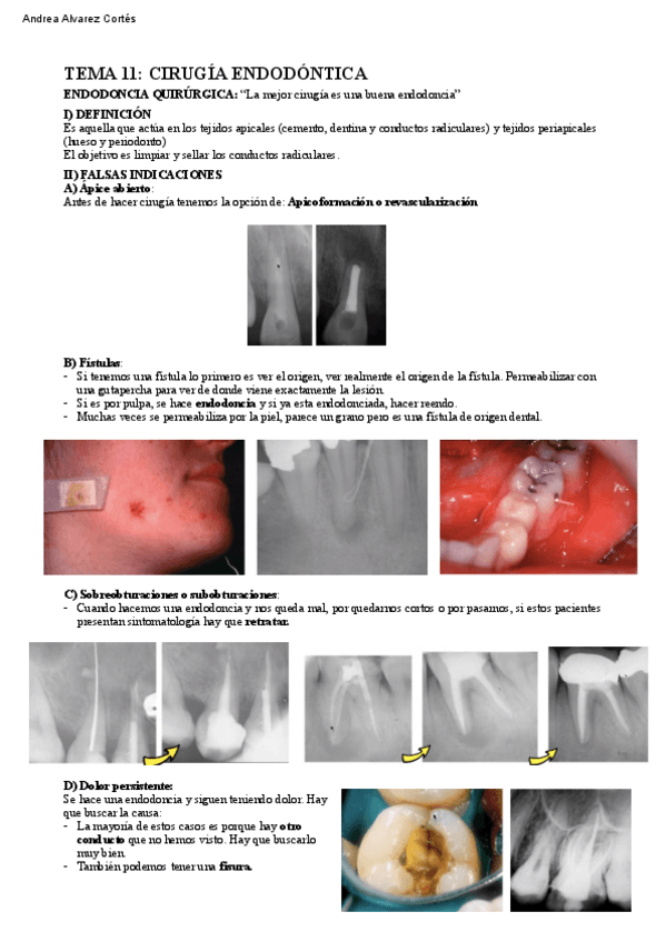 Miniatura del documento Tema-11-PTD-IV.pdf