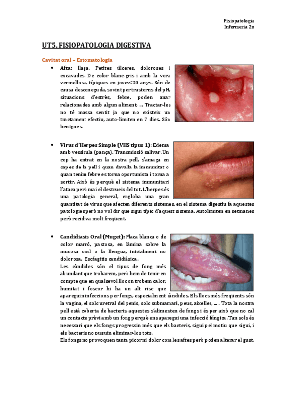 Miniatura del documento TEMA 5. Fisiopatologia digestiva.pdf