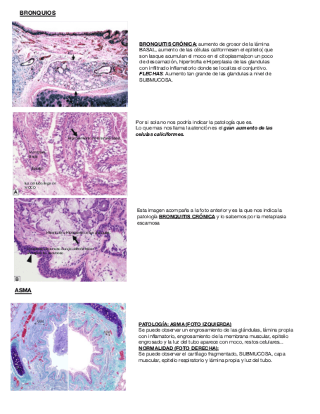 Miniatura del documento TRIVIAL-APARATO-RESPIRATORIO.pdf