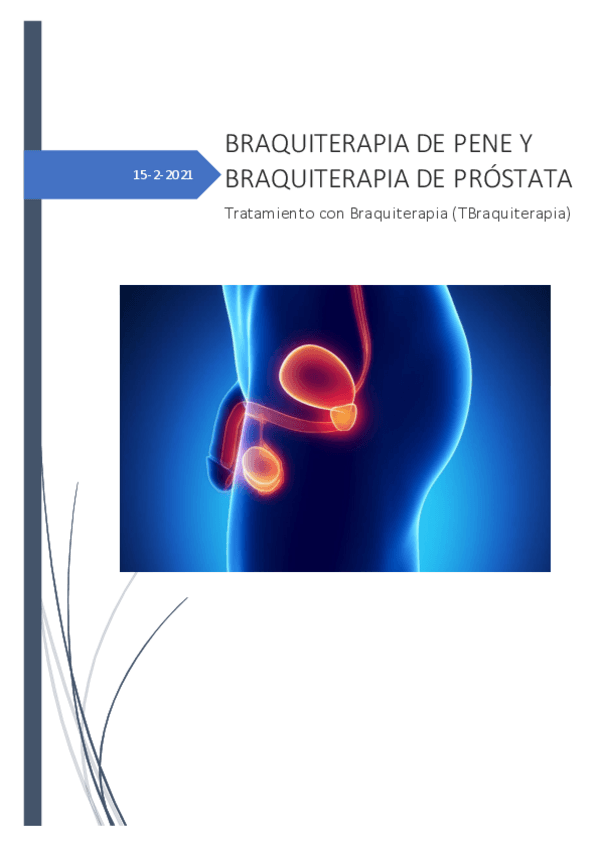 Miniatura del documento BRAQUITERAPIA-DE-PENE-Y-BRAQUITERAPIA-DE-PROSTATA.pdf