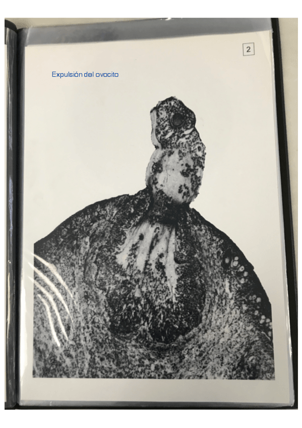 Miniatura del documento Cuadernillo-embriologia-solucion.pdf