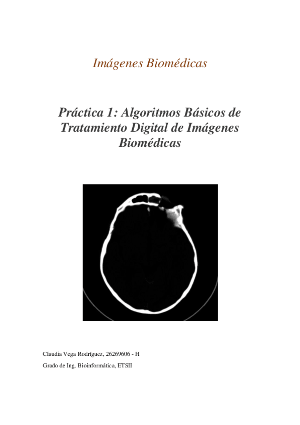 Miniatura del documento Memoria-Imagenes-Biomedicas-ClaudiaVegaRodriguez.pdf