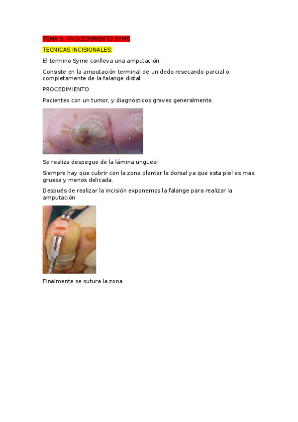 Miniatura del documento TEMA-5-TECNICA-SYME.docx