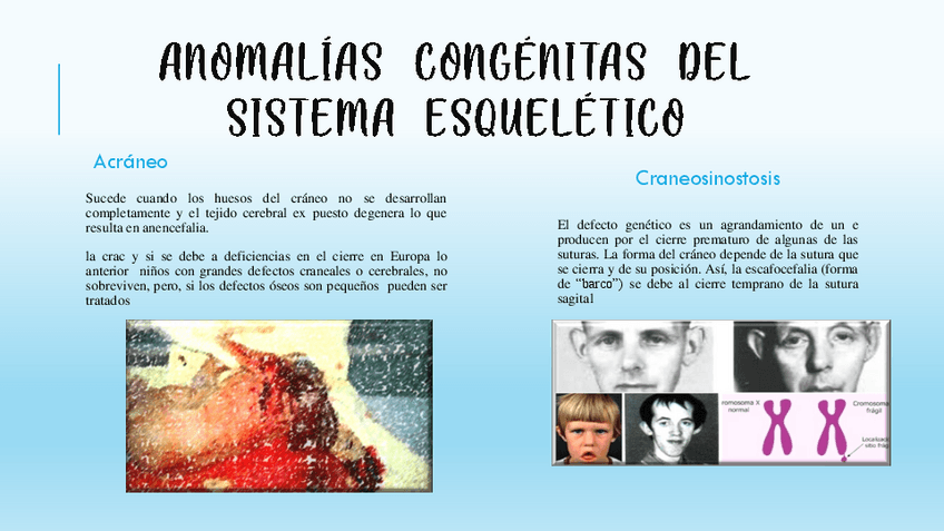Miniatura del documento Anomalias-congenitas-del-S.pdf