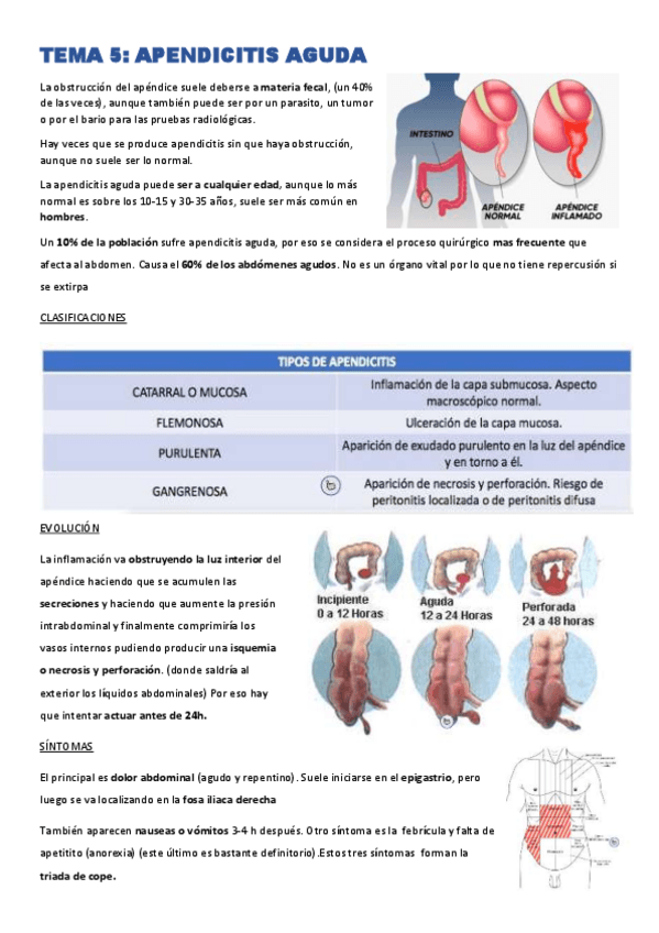 Miniatura del documento TEMA-5-apendicitis.pdf
