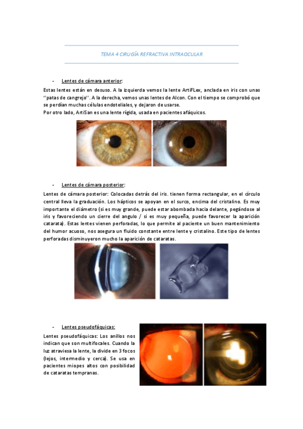 Miniatura del documento TEMA-4-CIRUGIA-REFRACTIVA-INTRAOCULAR.pdf