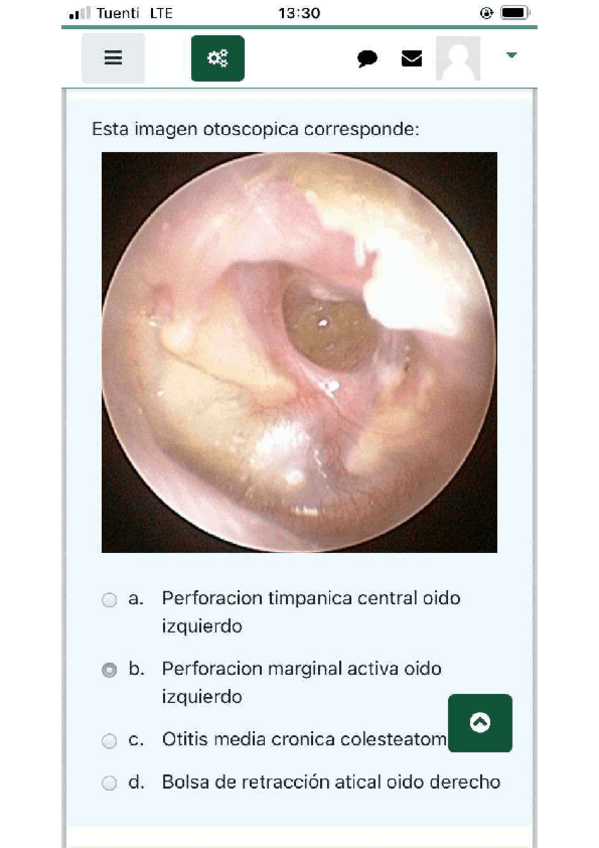 Miniatura del documento Test-Practicas-ORL-2021.pdf