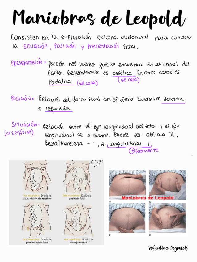 Miniatura del documento Maniobras-de-Leopold.pdf