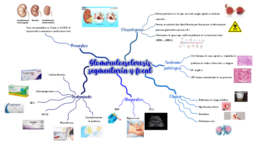 Miniatura del documento Glomerulonefritis-segmentaria-y-focal.pdf