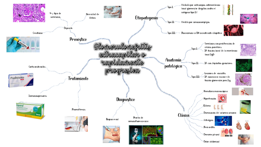 Miniatura del documento Glomerulonefritis-extracapilar.pdf