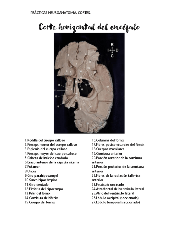 Miniatura del documento Corte-horizontal-del-encefalo.pdf