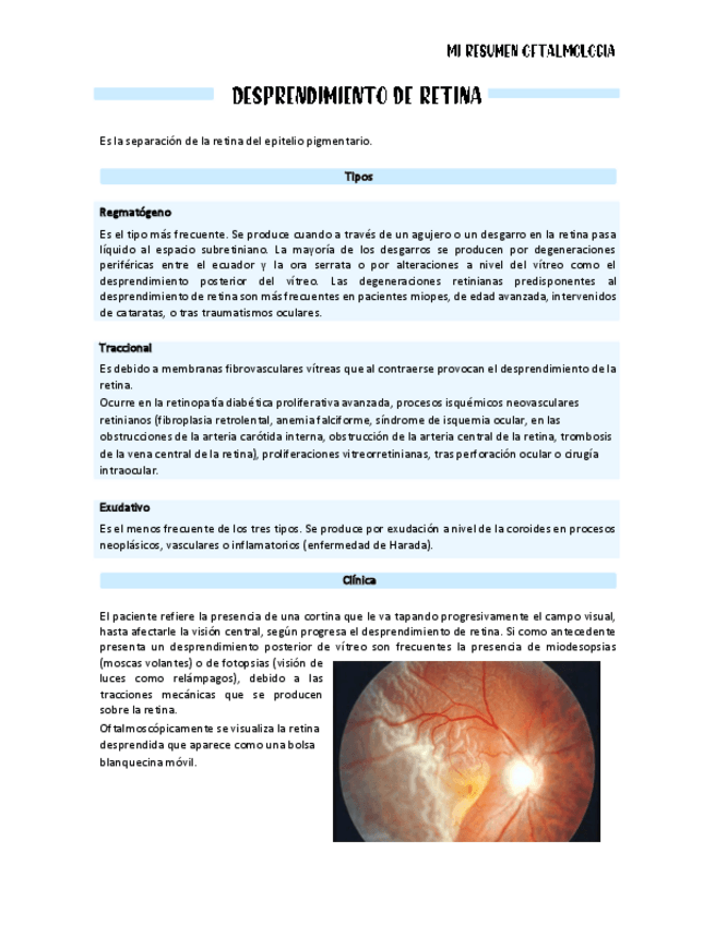 Miniatura del documento Desprendimiento-de-retina.pdf