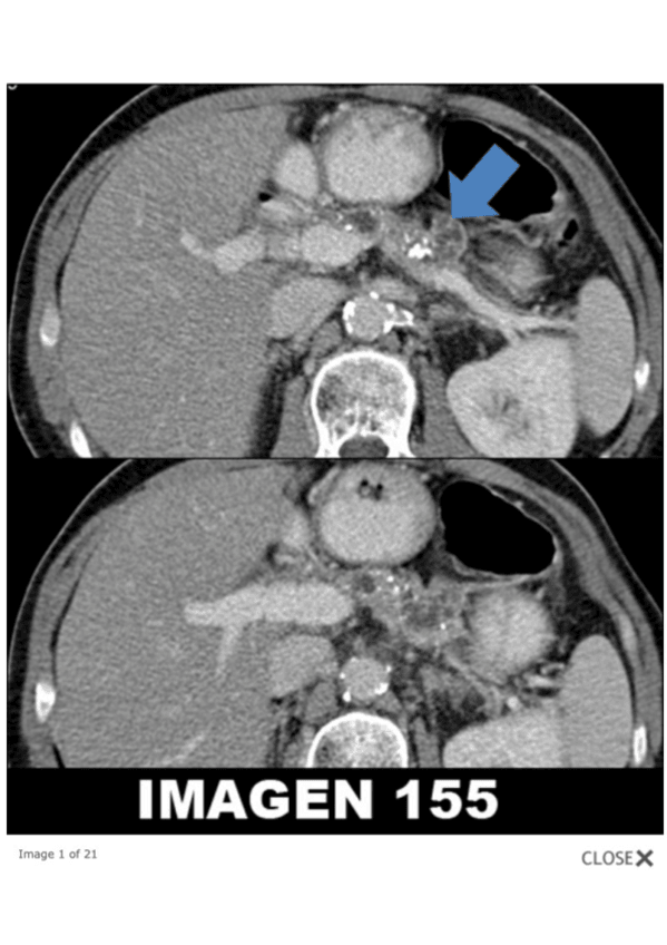 Miniatura del documento examen-dx-fotos.pdf