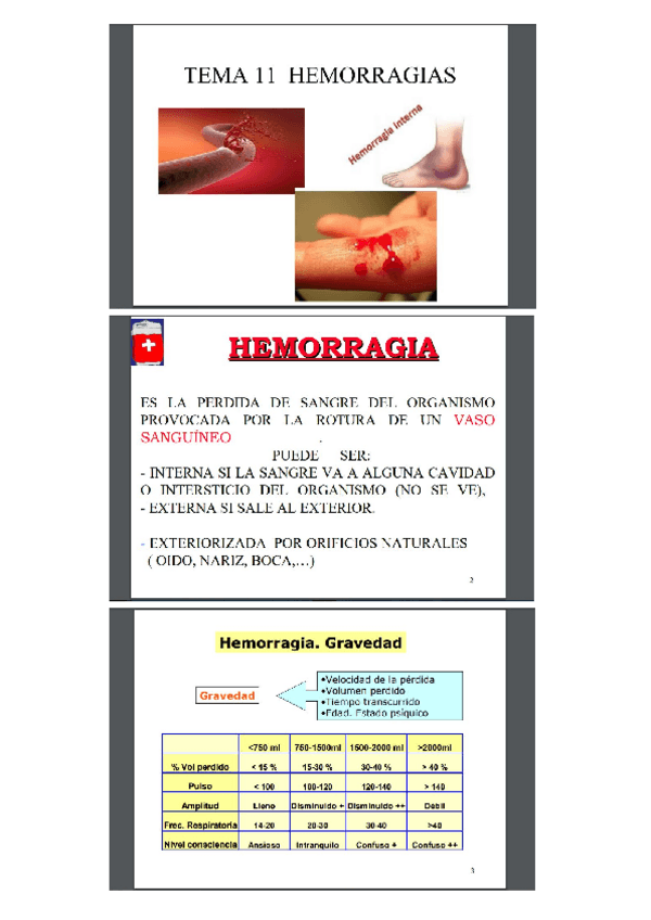 Miniatura del documento t11-hemorragias.pdf