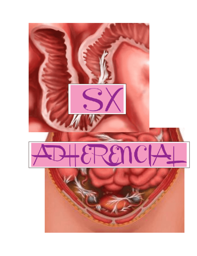 Miniatura del documento SX-ADHERENCIAL.pdf