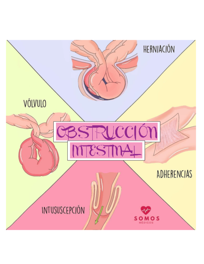 Miniatura del documento OBSTRUCCION-INTESTINAL.pdf