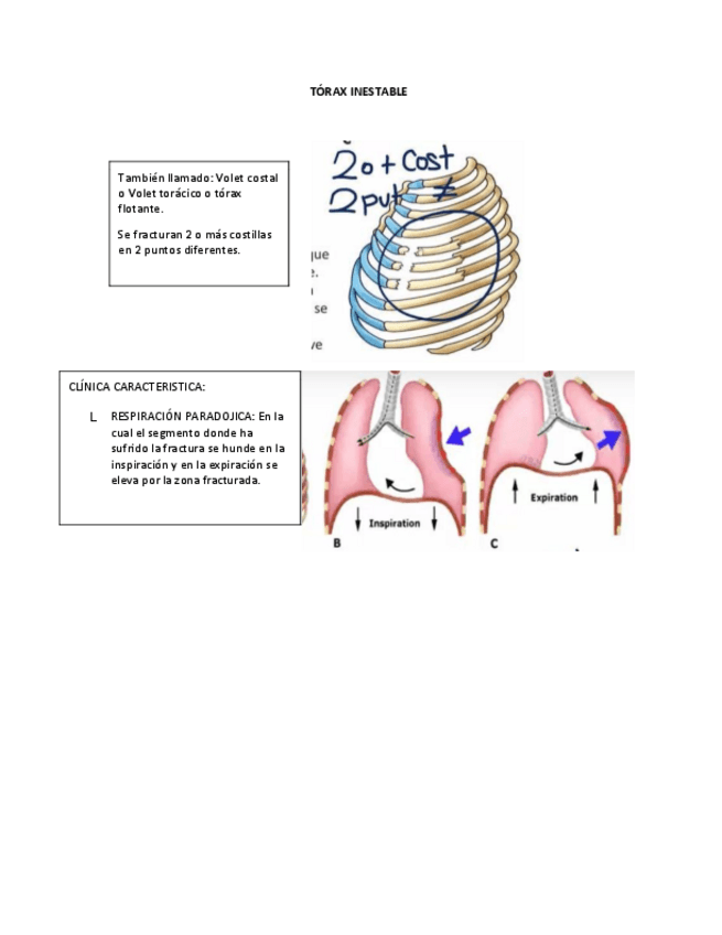 Miniatura del documento TORAX-INESTABLE.pdf