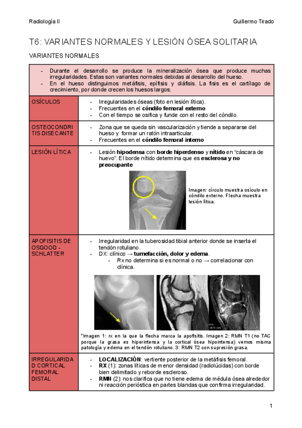 Miniatura del documento T6-Variantes-normales-y-lesion-osea-solitaria.pdf