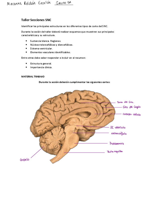 Miniatura del documento 4-Taller-Diseccion-Secciones-SNC.pdf