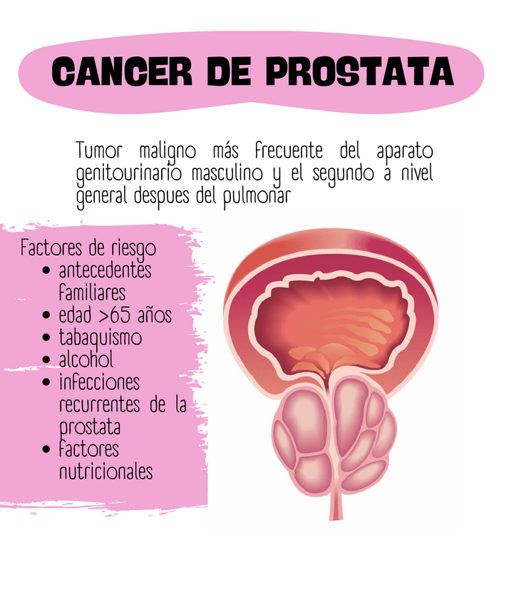 Miniatura del documento Ca-prostata.pdf