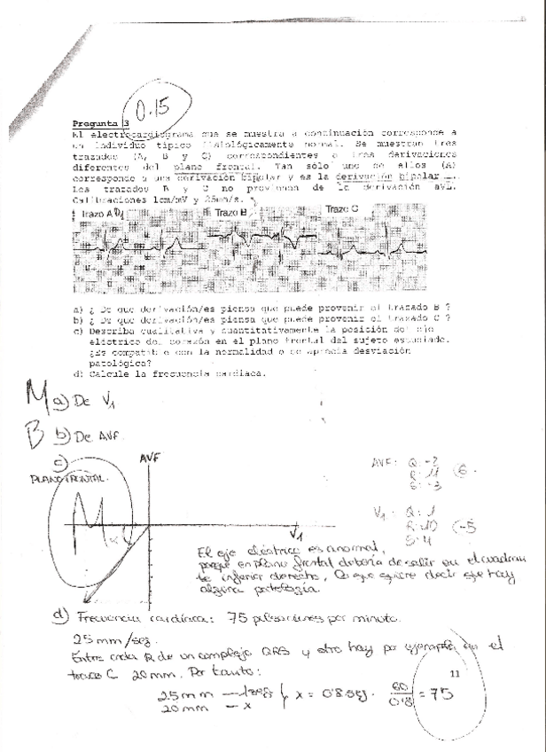 Miniatura del documento pregunta del electrocardiograma#.pdf