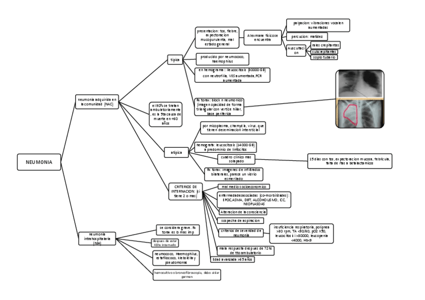 Miniatura del documento neumonia-.pdf